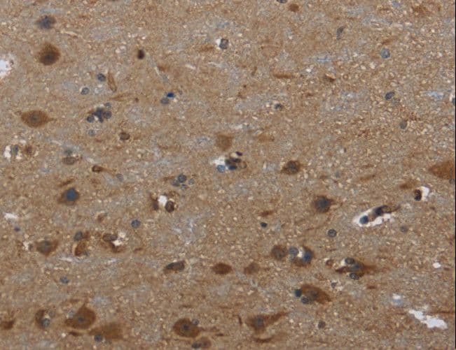Polyclonal Rabbit anti-Human GYS1 / Glycogen Synthase Antibody (IHC, WB)