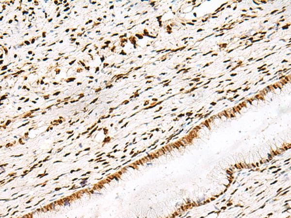 Polyclonal Rabbit anti-Human DNPEP Antibody (IHC)