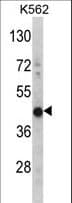 HIBCH Antibody (aa183-209)