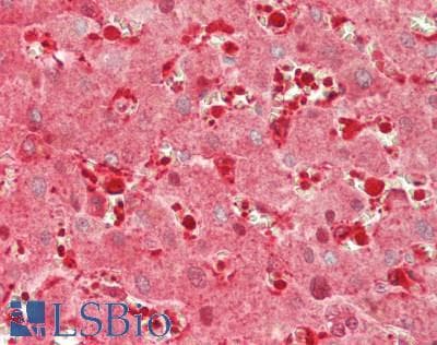 IHC-plus™ Polyclonal Rabbit anti-Human GPI Antibody (aa2-554, IHC, IF, WB)