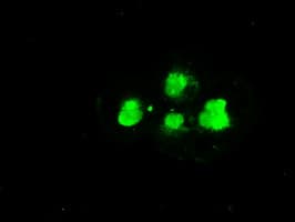 Monoclonal Mouse anti-Human SSB / La Antibody (clone OTI3F11, IHC, IF, WB)