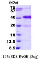 Human MARCKSL1 Protein (Recombinant His)