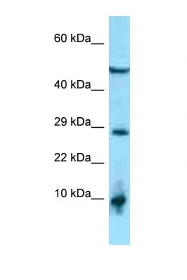 ATRAID / C2orf28 Antibody (aa182-231)