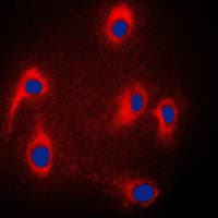 MAPK8IP3 / JIP3 Antibody (Internal)