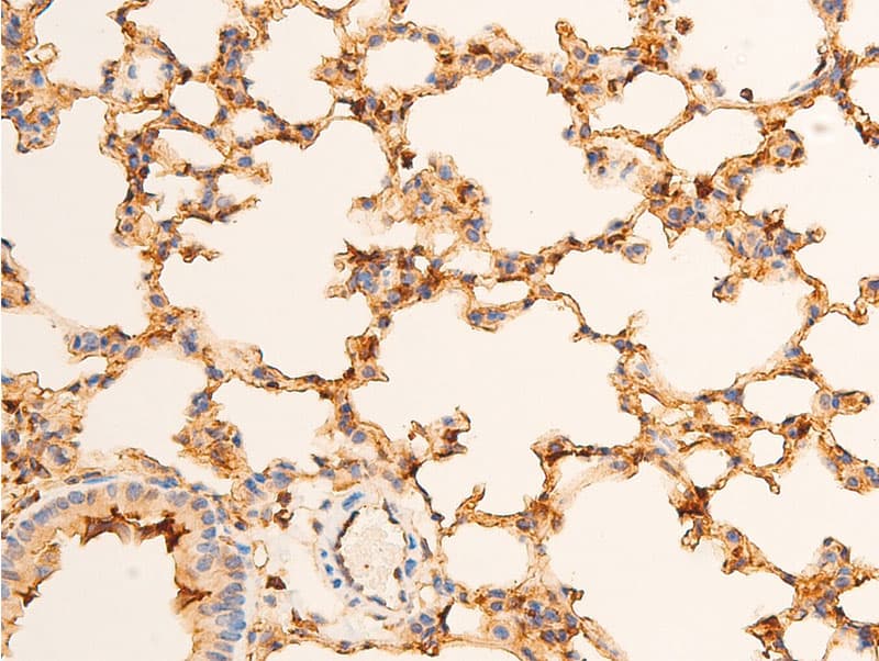 TP73 / p73 Antibody (phospho-Tyr99)