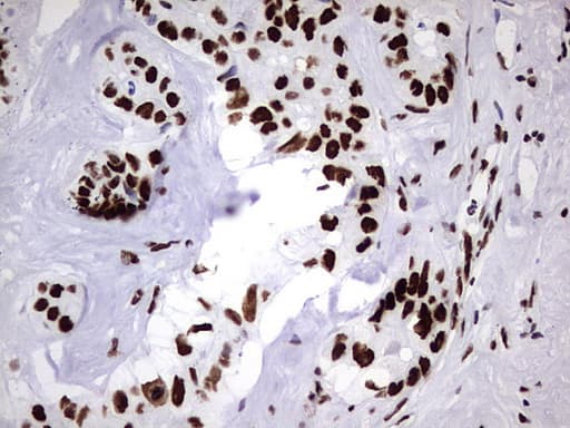 HNRPM / HNRNPM Antibody (aa1-261, clone OTI4C9)