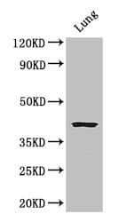 Polyclonal Rabbit anti-Human CYSLTR1 / CYSLT1 Antibody