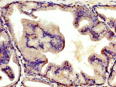 AGT / Angiotensinogen Antibody (aa44-427)