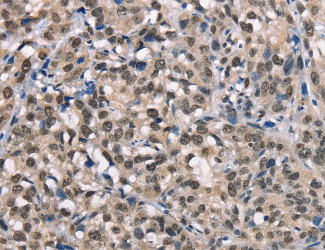 NDNL2 Antibody