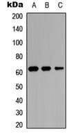 IL20RA Antibody (Internal)