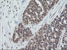 COPS5 / JAB1 Antibody (clone OTI2B12)