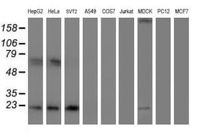 UBE2E3 Antibody (clone OTI1B4)