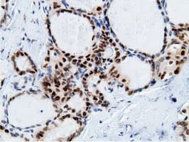 EPM2AIP1 Antibody (clone OTI2G3)