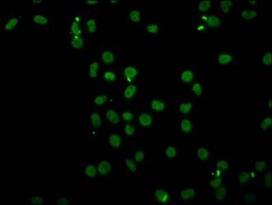 HIST1H4I Antibody