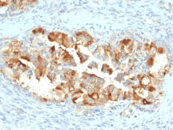 Monoclonal Mouse anti-Human MSLN / Mesothelin Antibody (clone MSLN/2131, IHC)