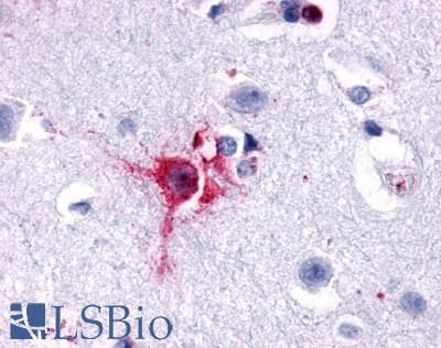 PathPlus™ Polyclonal Rabbit anti-Human OPRD1 / Delta Opioid Receptor Antibody (N-Terminus, IHC)