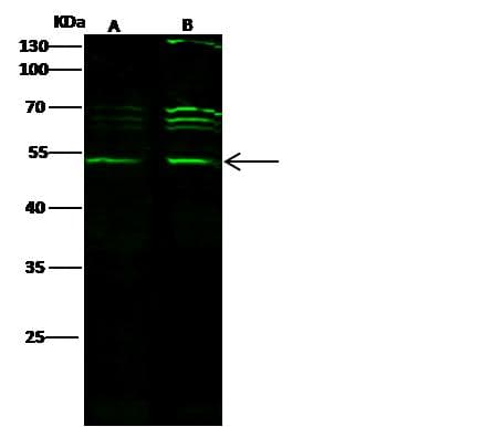 Polyclonal Rabbit anti-Human CTBP1 / CTBP Antibody (Preservative Free, IHC, IF, WB)