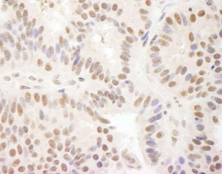 Polyclonal Rabbit anti-Human MAML3 / CAGH3 Antibody (aa150-200, IHC, WB)