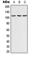 Polyclonal Rabbit anti-Human RAB3GAP1 Antibody (Internal, WB)