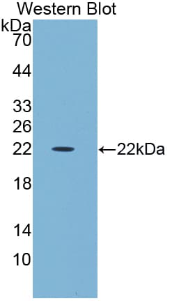 GPT / Alanine Transaminase Antibody (aa29-181)