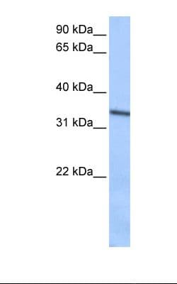SEPT9 / Septin 9 Antibody (C-Terminus)