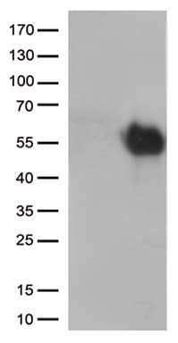 HAVCR2 / TIM-3 Antibody (clone OTI2E11)
