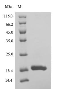 Drosophila melanogaster Ubc6 Protein (Recombinant 6His, N-terminus)