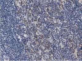 PRKD2 / PKD2 Antibody (clone OTI4F1)