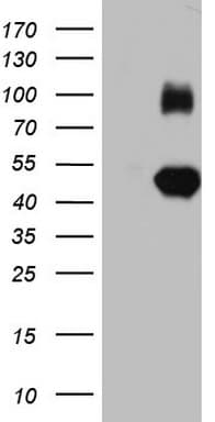 IGSF11 / VSIG3 Antibody (aa23-241, clone OTI2A5)