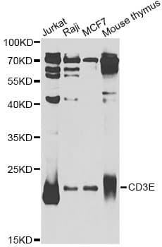 Polyclonal Rabbit anti-Human CD3E Antibody (IHC, IF, WB)