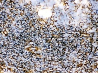TGM2 / Transglutaminase 2 Antibody