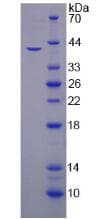 Human HEPH / Hephaestin Protein (Recombinant His)