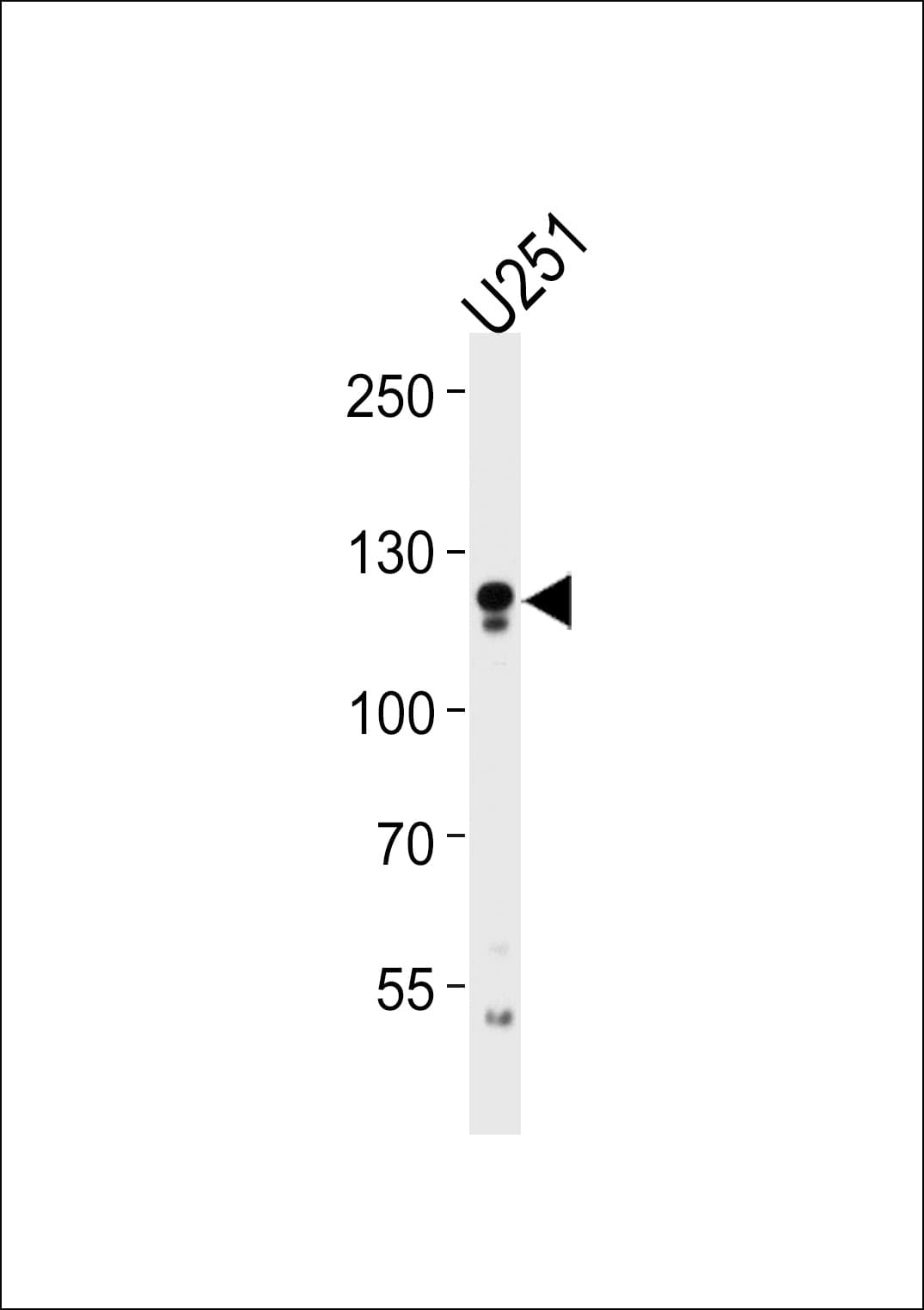 ECE2 Antibody (aa551-579)