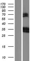 LAIR1 / CD305 Protein (Over-Expression Lysate Myc-DDK (Flag))