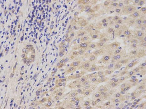 ADAM9 Antibody