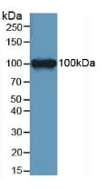 LEPR / Leptin Receptor Antibody (aa22-203)