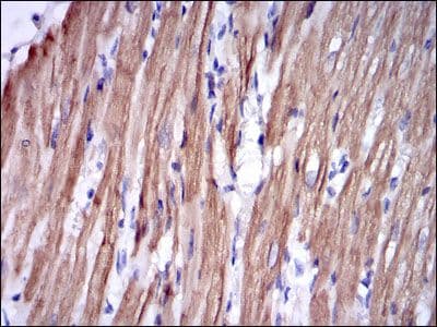TNNI2 Antibody (clone 2F12A11)