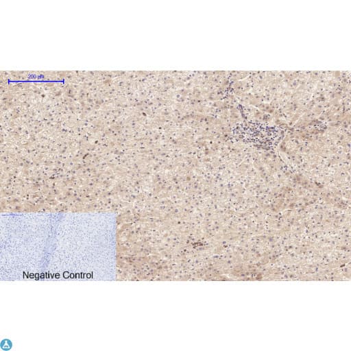 Polyclonal Rabbit anti-Human APP / Beta Amyloid Precursor Antibody (WB)