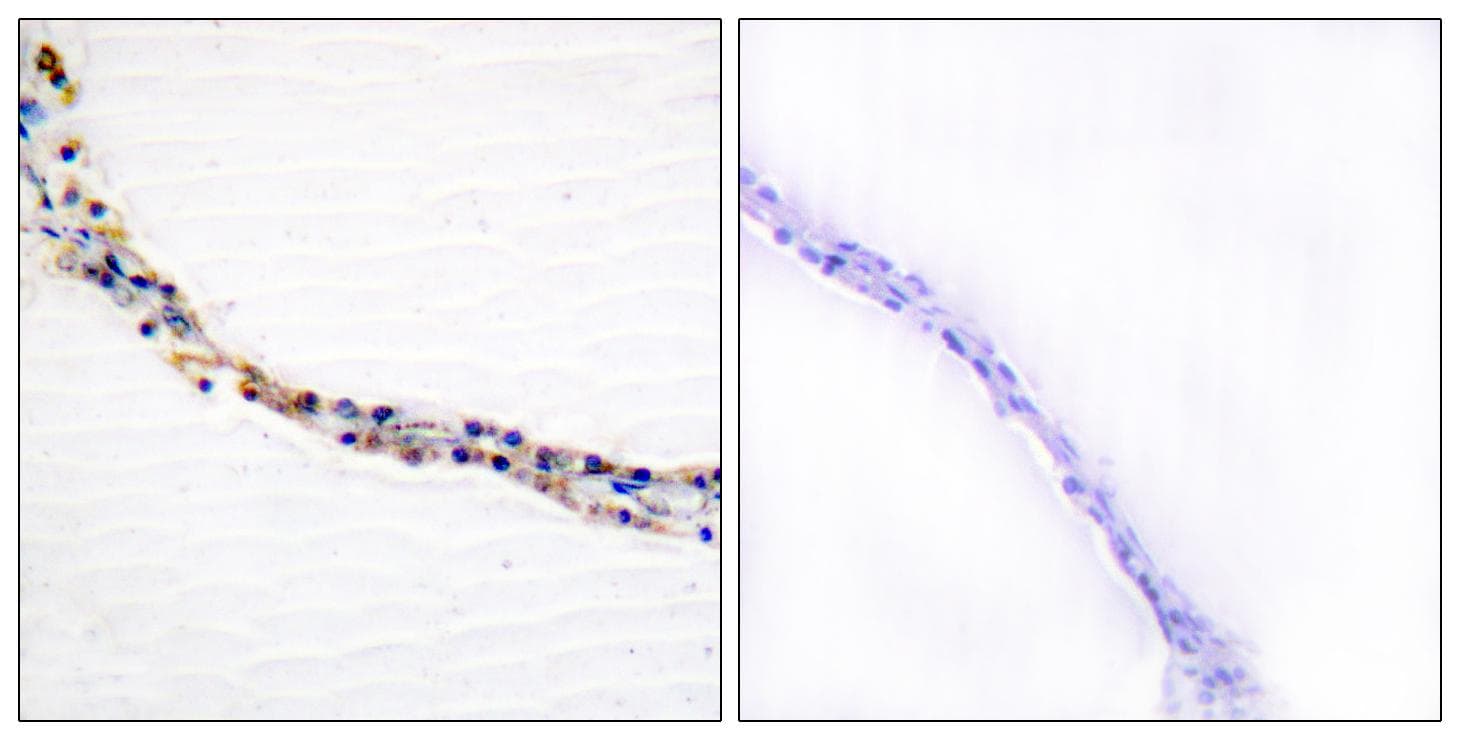 FN1 / Fibronectin Antibody