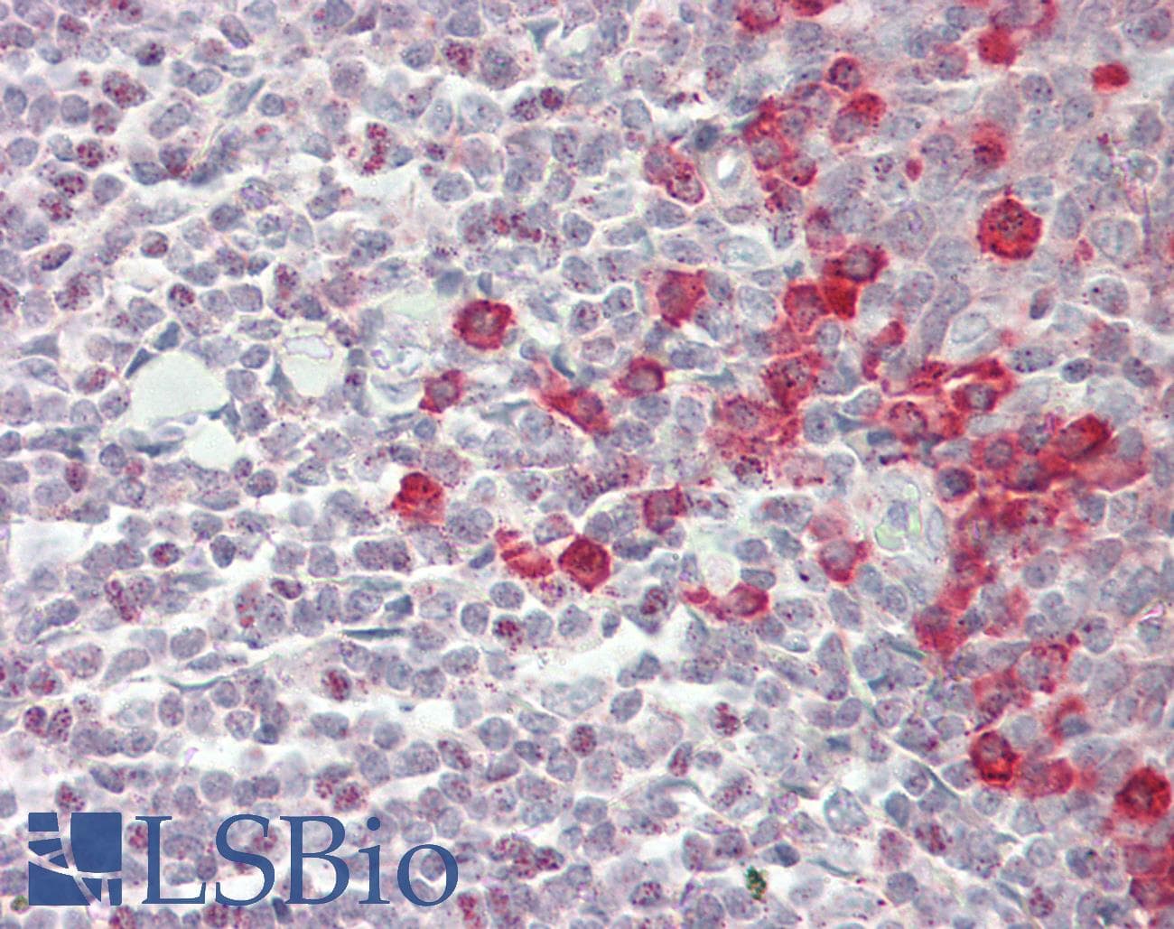 PathPlus™ TGFBR2 Antibody (aa13-40)