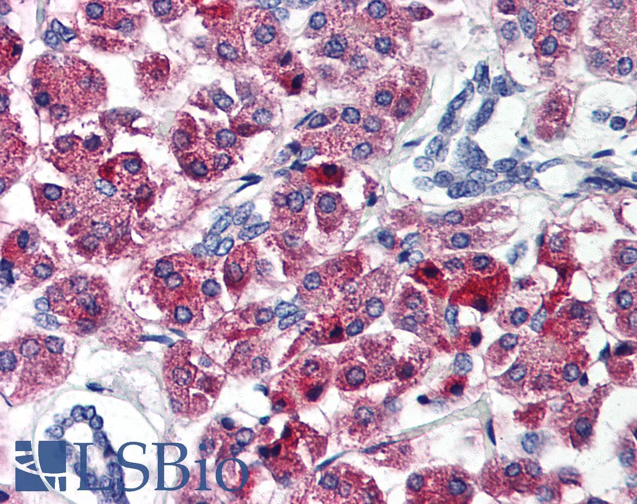 IHC-plus™ Polyclonal Rabbit anti-Human Tuberin / TSC2 Antibody (IHC, IF, WB)