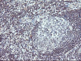 TPD52L3 Antibody (clone OTI3D11, Carrier-free)
