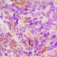 TTBK2 Antibody