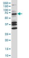 COIL / Coilin Antibody (clone 4B8)