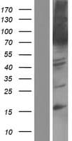 Human PEX5 Protein (Over-Expression Lysate Myc-DDK (Flag))