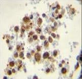 Polyclonal Rabbit anti-Human TS / Thromboxane Synthase Antibody (aa226-257, IHC, WB)