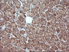 MAP2K1 / MKK1 / MEK1 Antibody (clone OTI7B1)