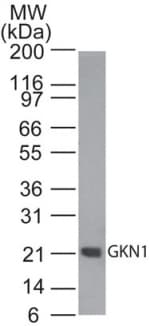 GKN1 / Gastrokine 1 Antibody (aa100-150)