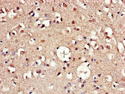 Polyclonal Rabbit anti-Human AAK1 Antibody (IHC, IF, WB)
