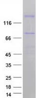 Human DUOX Protein (Recombinant Myc-DDK (Flag))